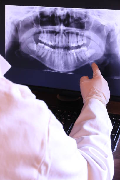 Best Urgent Care for Lost Fillings or Crowns in Leona Valley, CA